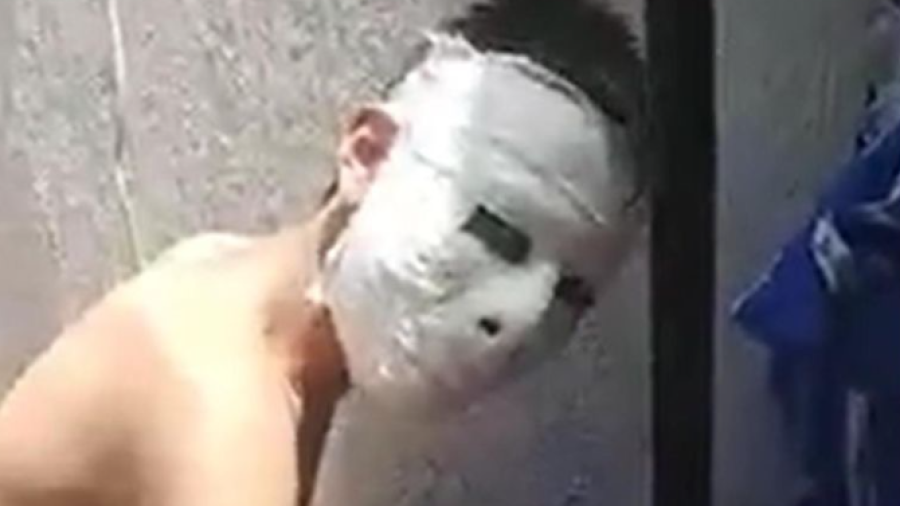 Joven hace máscara de yeso y se le queda pegada al rostro