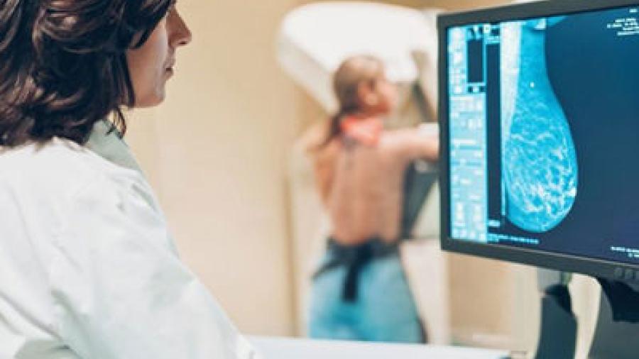 Google Health desarrolla sistema que identifica el cáncer de mama 