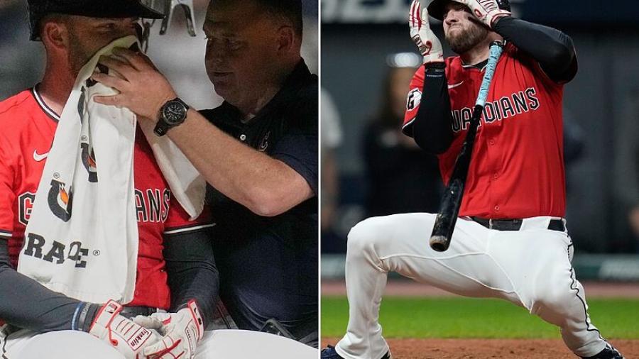 David Fry sufre fracturas faciales tras brutal pelotazo en la MLB