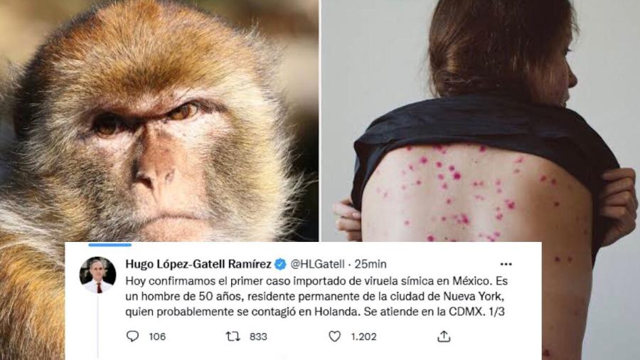 Confirma Hugo López-Gatell primer caso importado de viruela del mono en México