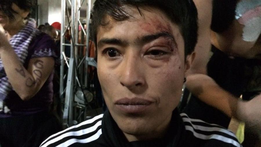 Golpean a activista en marcha; acusa a Frente Popular Francisco Villa