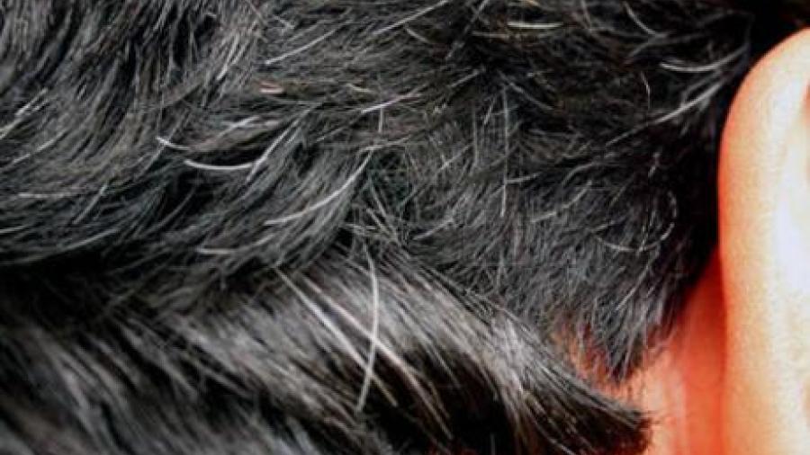 Descubren pastillas que eliminan canas