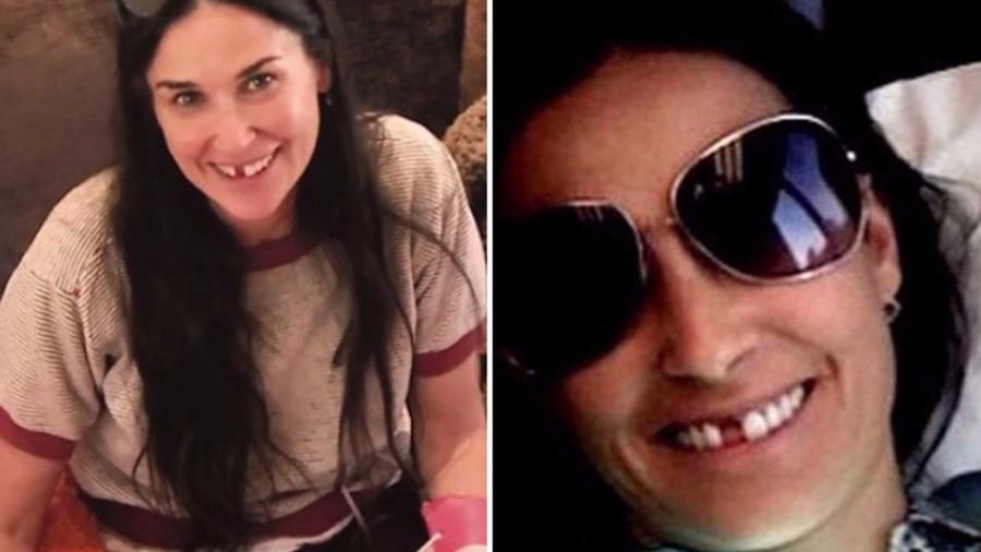 Demi Moore pierde dientes debido al estrés