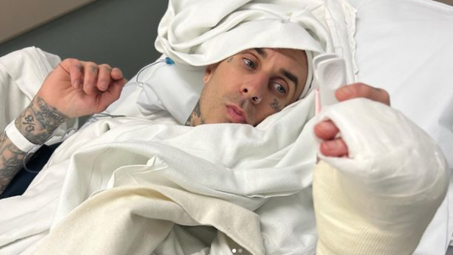 Travis Barker comparte foto de su operación del dedo