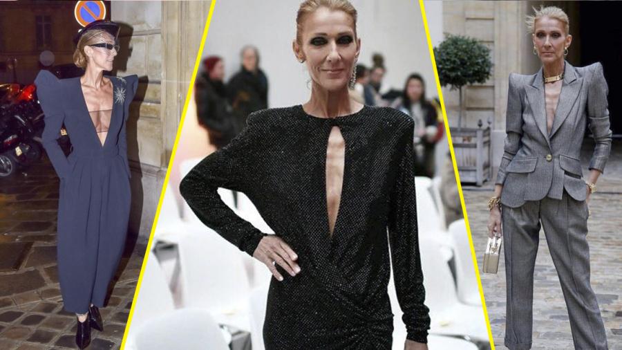 La extrema delgadez de Céline Dion