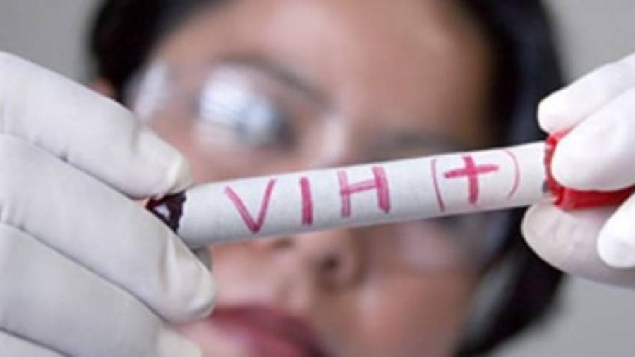 Preocupan casos de VIH en jóvenes