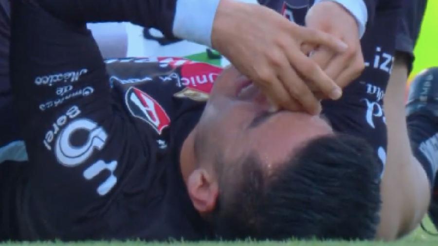 Aldo Rocha sufre lesión y podría perderse el Clásico Tapatío