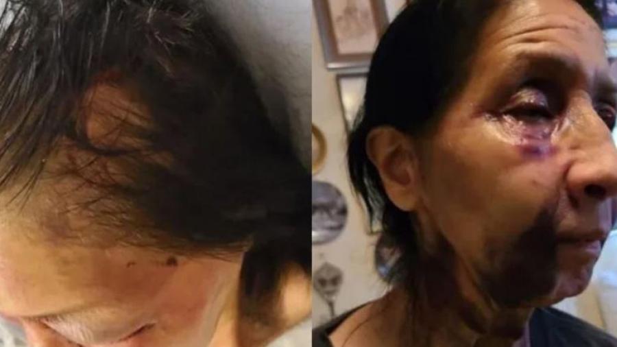 Mujer afroamericana golpea a mexicana por creer que era asiática 