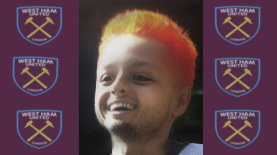 Presume West Ham foto de 'Chicharito' con filtro de bebé