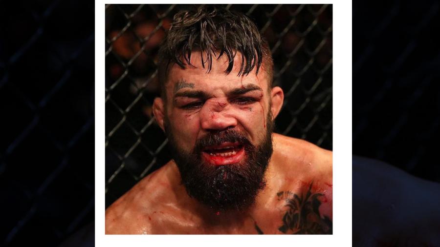 Mike Perry sufre lesión durante pelea