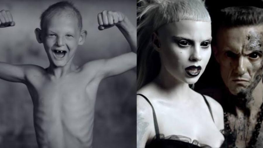 Hijo adoptivo de Die Antwoord los acusa de abuso sexual