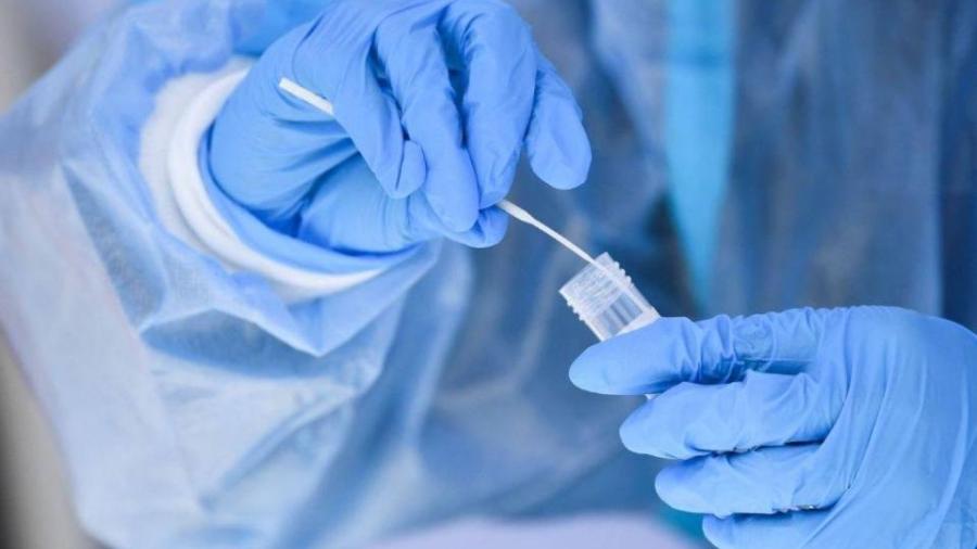 Israel anuncia descubrimiento de variante ‘desconocida’ del Covid-19