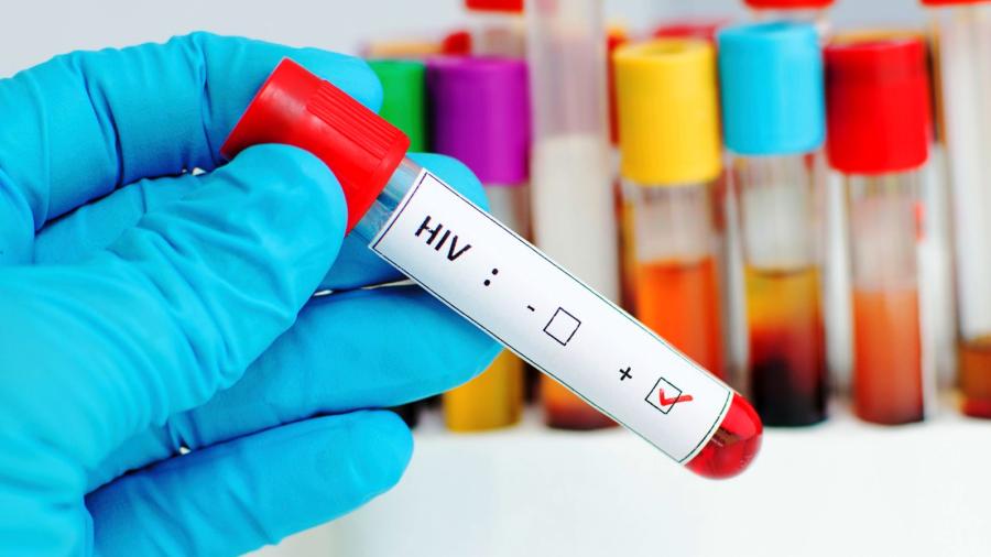 Ven posibilidad de crear vacuna contra VIH