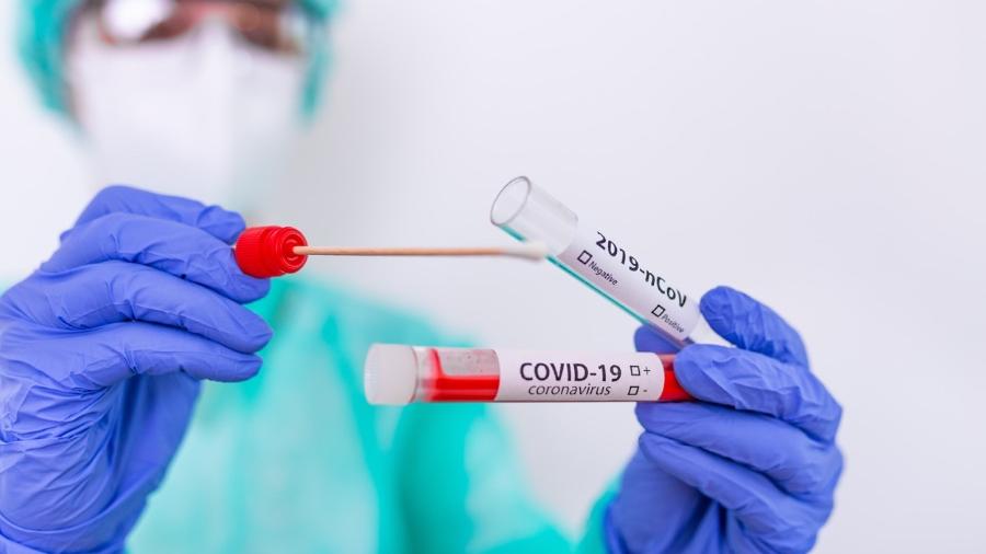 Fallas en sistema de salud deja sin contabilizar 300 mil pruebas de covid-19 en California