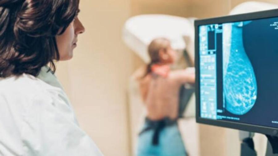 Presentan Modelo de Atención Universal para el Cáncer de Mama en México; habrá tratamiento sin importar derechohabiencia