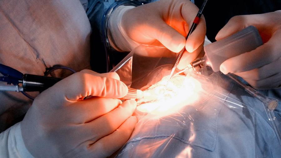 Mantienen campaña de cirugía de Pterigion 