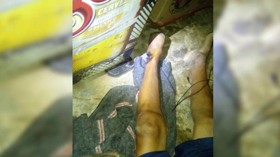 Muere hombre por descarga eléctrica de enfriador de cerveza