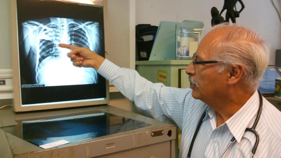 Se reducen casos de Tuberculosis en Matamoros