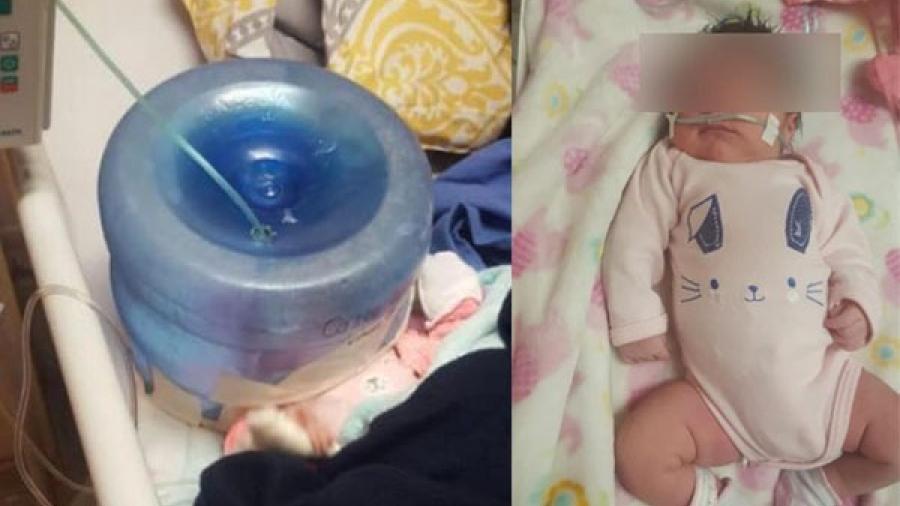 Hospital en Sonora usa garrafón como casco de oxígeno para bebé