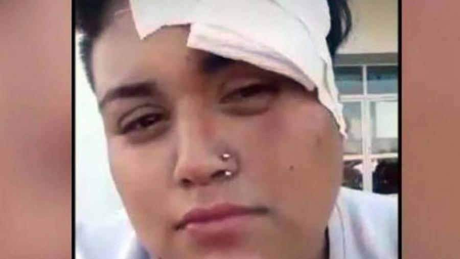 Pandilla golpea brutalmente a joven lesbiana