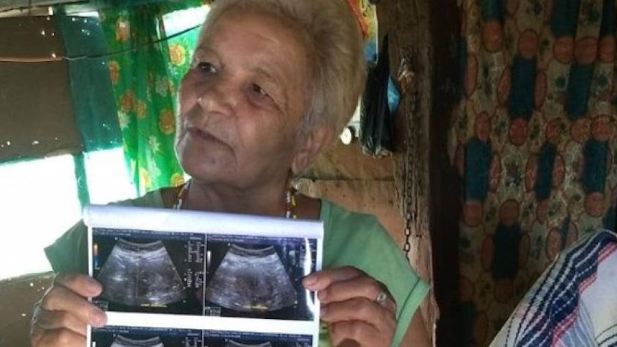 Mujer de 70 años podría convertirse en la más longeva en dar a luz