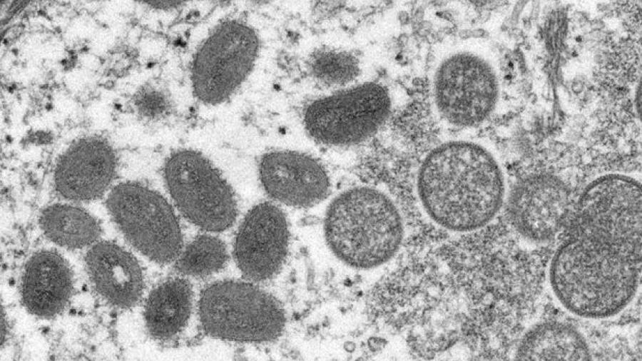 SSa lanza aviso epidemiológico por emergencia sobre brote de mpox
