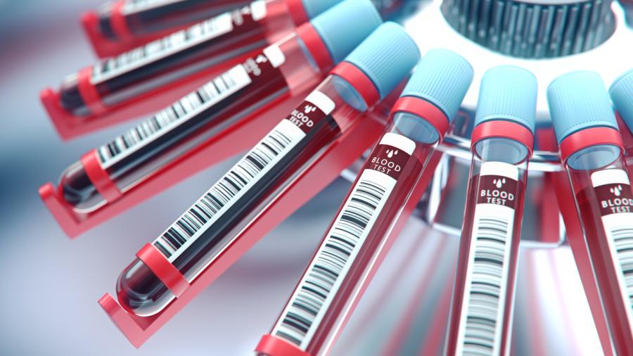 Crean prueba que detecta siete tipos de cáncer