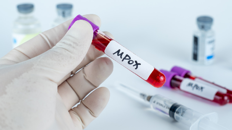 Tailandia confirma el primer caso en Asia de la nueva variante de mpox