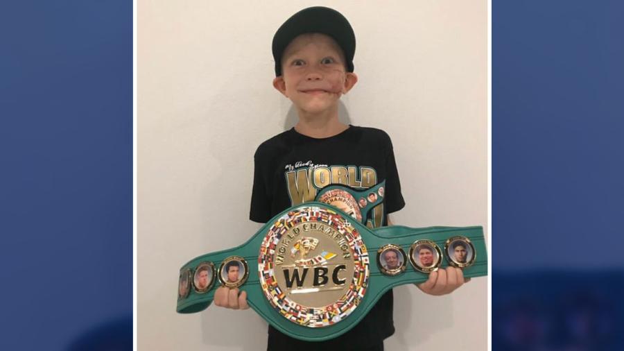 Bridger Walker es “el hombre más valiente en la Tierra” por el CMB