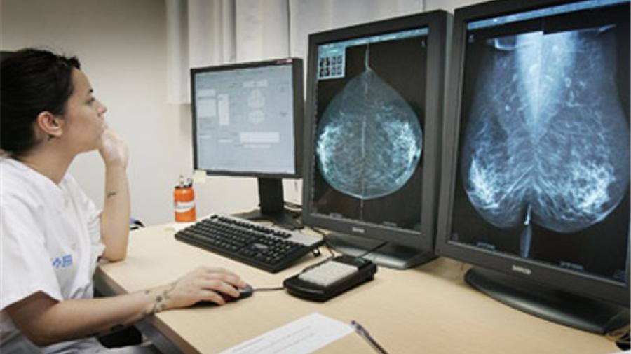 Llega primer lote de resultados de mamografías